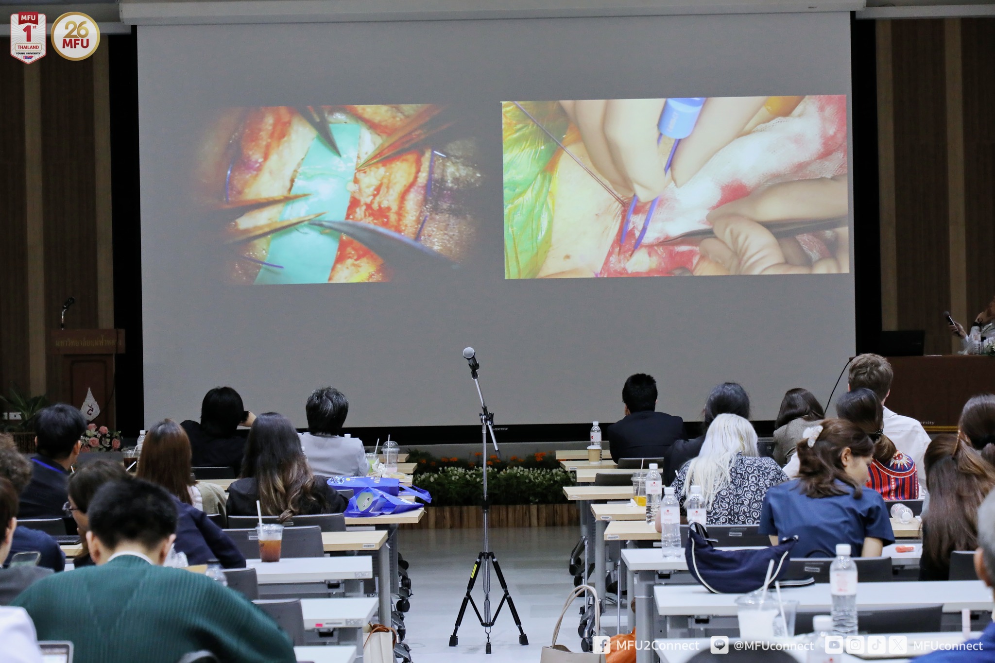 Mae Fah Luang University Medical Center Hospital Co-Hosts International Academic Conference: “Pre-Congress Beyond the Frontiers: Supermicrosurgery and Ultrasonography in Lymphatic Surgery” to Advance Lymphatic Treatment